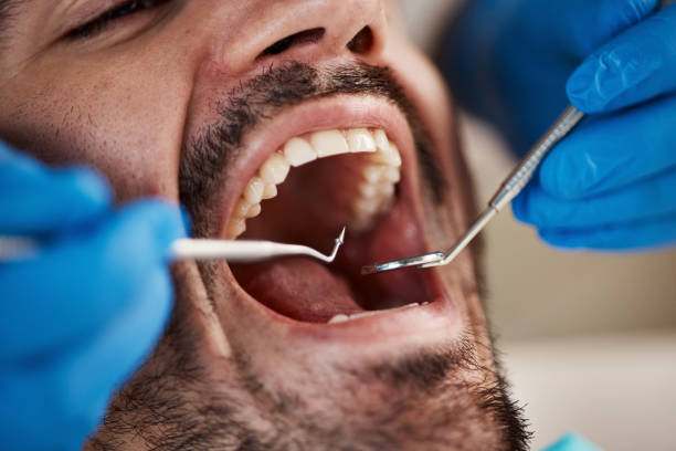 Best Urgent Care for Lost Fillings or Crowns in Westway, TX