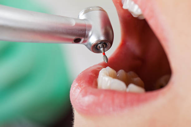 Best Same-Day Emergency Dental Services in Westway, TX
